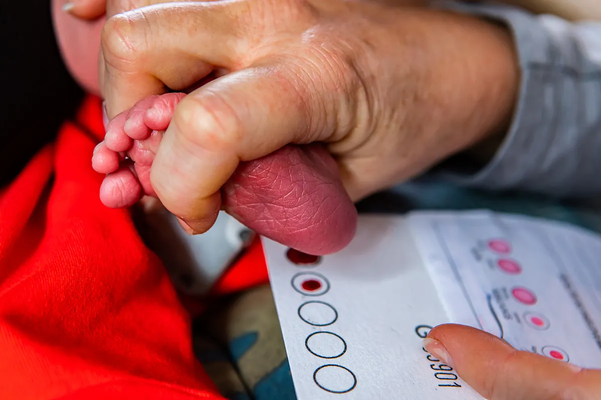 Hyperkolers familiares. Incluir la prueba del talón Esta enfermedad es beneficiosa y "Dar a los niños una oportunidad de vida más saludable"