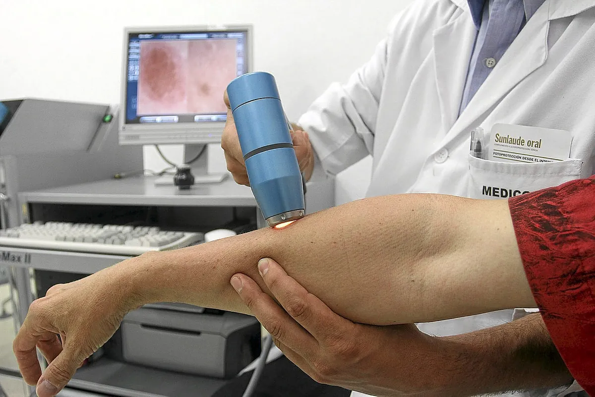 La infección por un virus general mejora la respuesta al tratamiento del melanoma