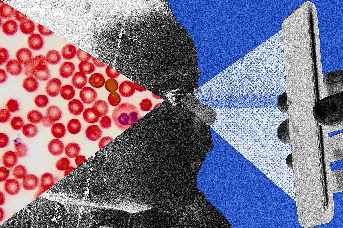 El abuso de niños deja una señal durante la infancia y la adolescencia. "Hemos encontrado un ejemplo en la sangre"