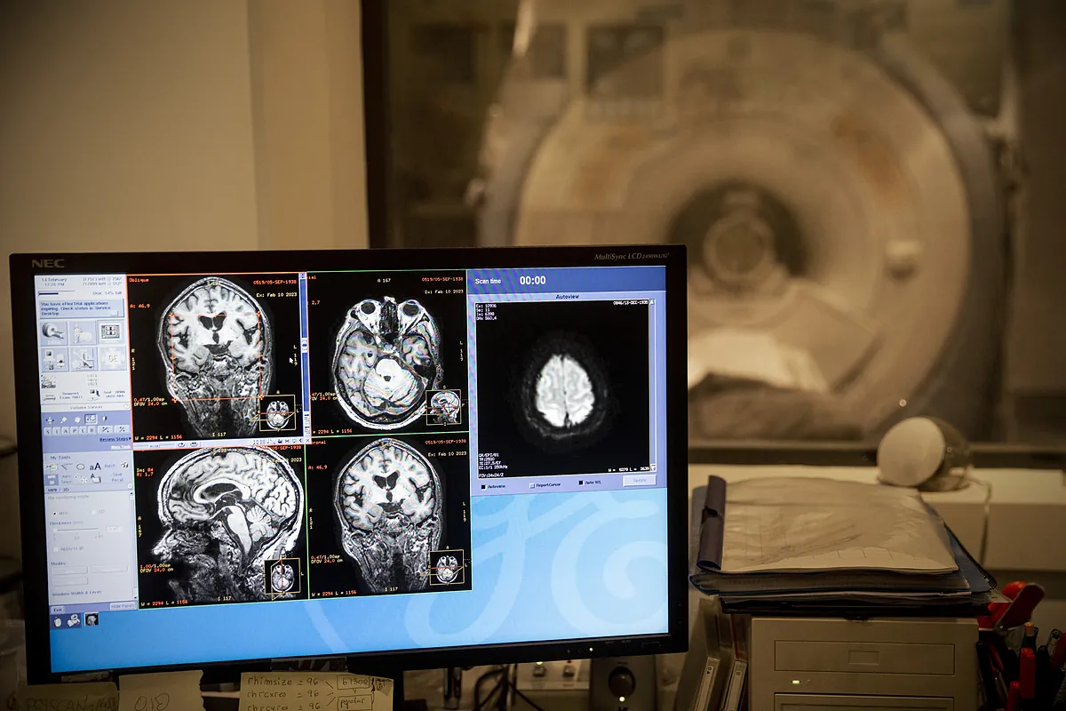 El sufrimiento de los trastornos del estante aumenta el riesgo de Alzheimer y Parkinson. "La salud intestinal es la salud del cerebro"