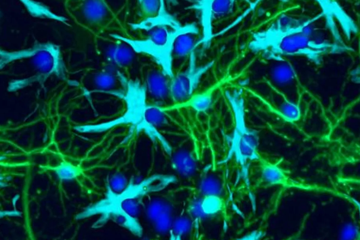 La interrupción de Neuron Chemical Messenger puede detener el tumor infantil más popular