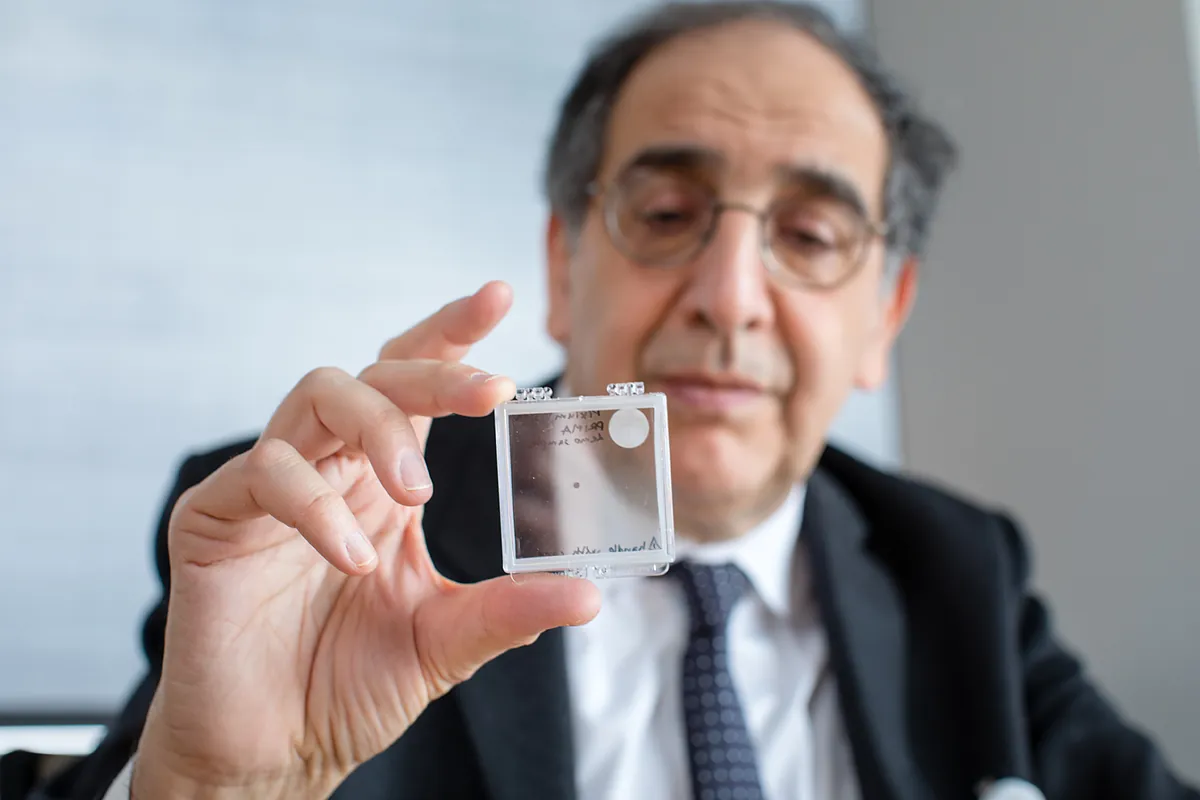 El implante de retina inalámbrico restaura la visión central y duplica la supervivencia en la DMAE. "Yo era un ávido lector y quería recuperarlo."