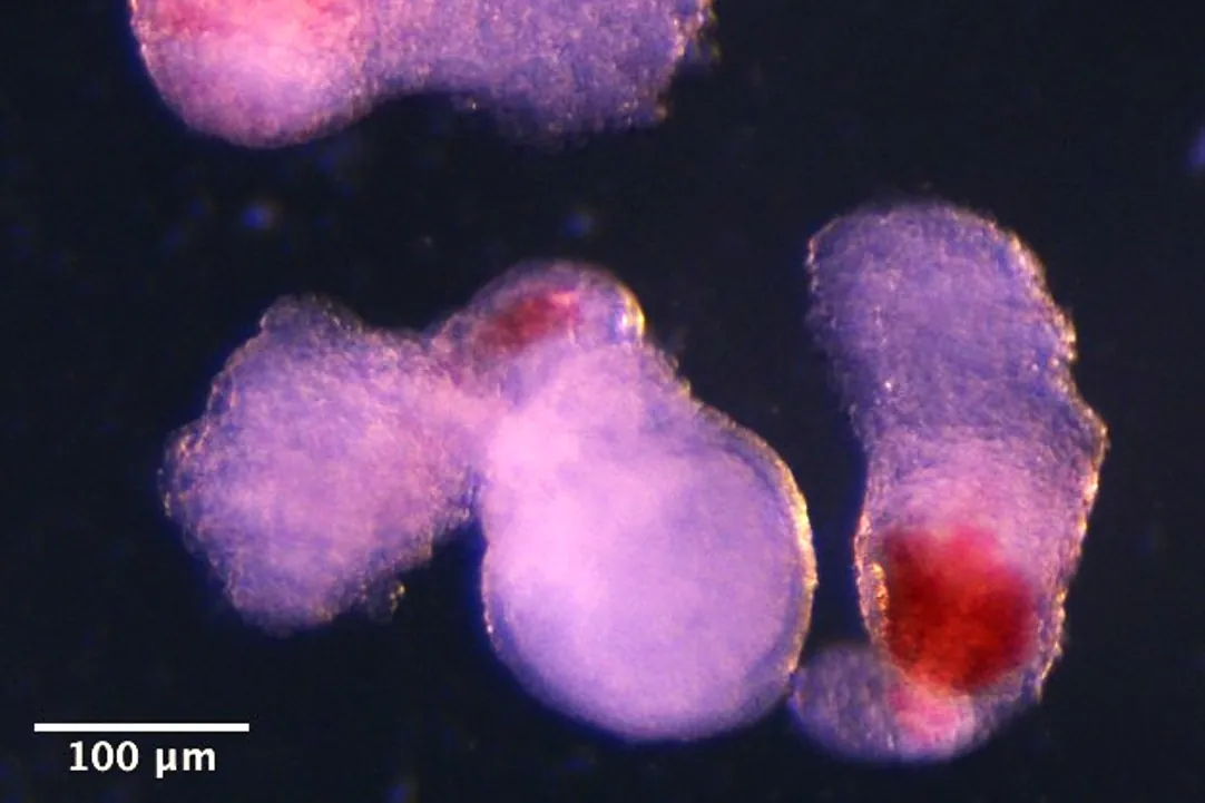 Los científicos de Cambridge están desarrollando modelos de embriones de laboratorio que producen células sanguíneas o "hubettoide"