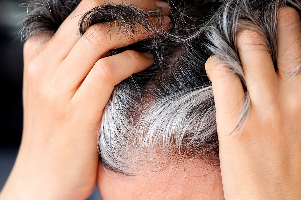 Canas o cáncer. Descubren que las canas son el mecanismo de defensa de nuestro organismo