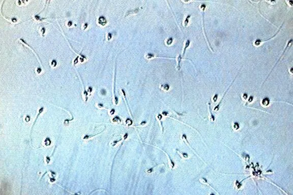 En España nacieron diez niños de un donante de esperma portador de un gen cancerígeno