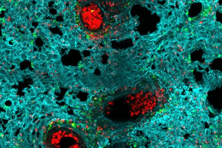 NeuMap, el primer atlas de neutrófilos que redefine su papel en la salud, la infección y la inflamación