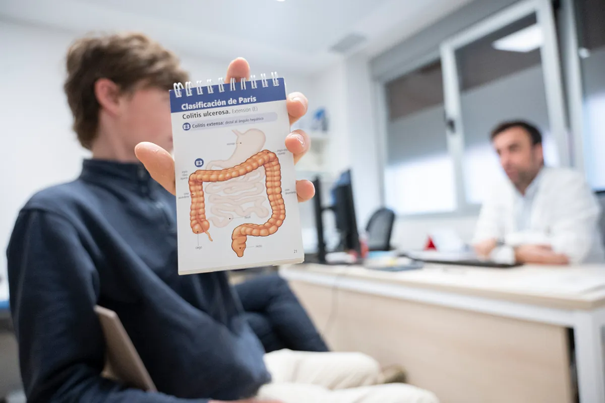 Cuatro pastillas de microbiota previenen la colostomía en un adolescente con colitis ulcerosa