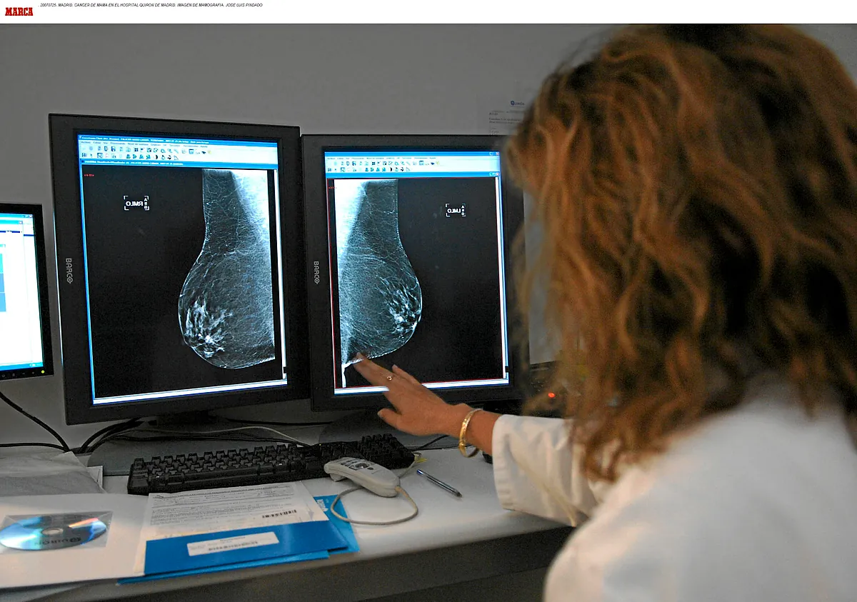 La mortalidad por cáncer de mama en España ha caído más de un 40% en las últimas tres décadas