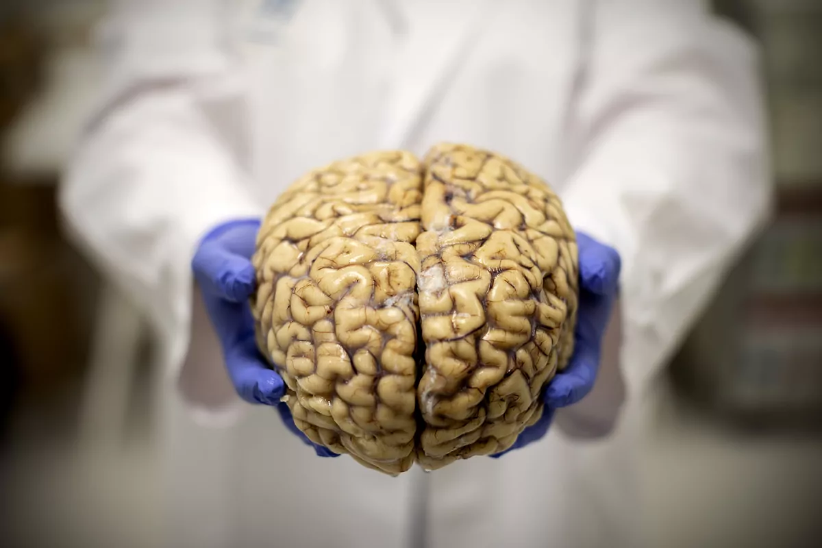 La terapia AUTO, que ya se utiliza con éxito contra algunos tumores, también se estudia contra el Alzheimer