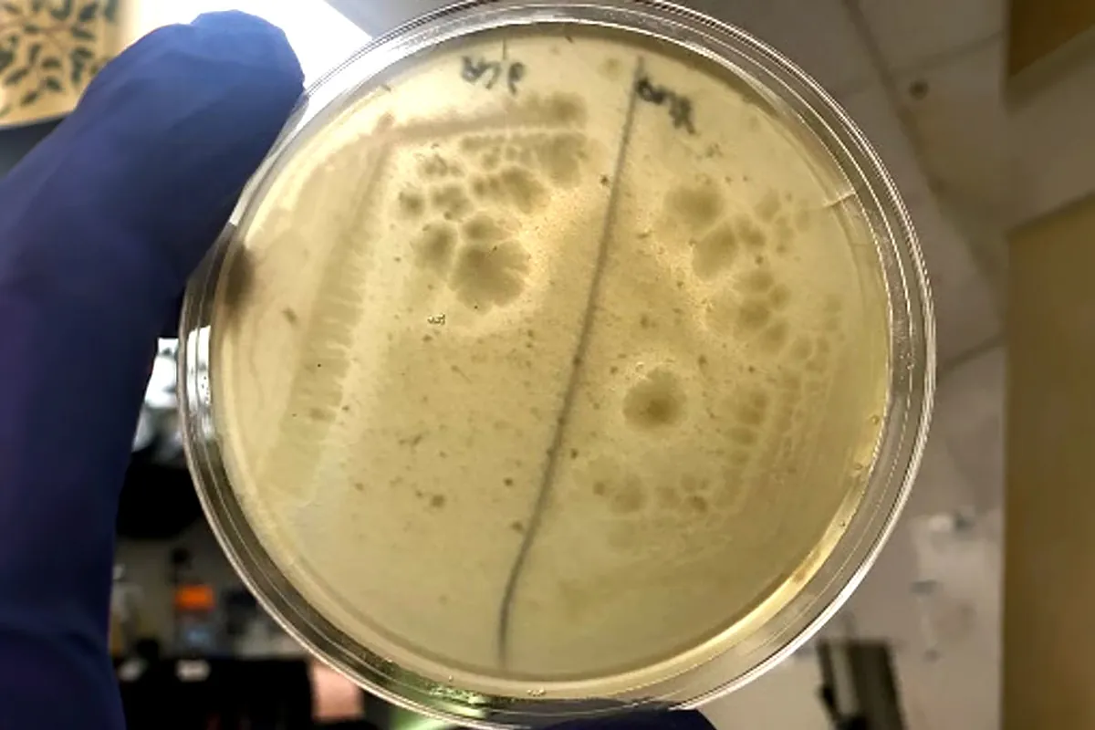 Las bacterias en la saliva ‘protegen’ contra la alergia al maní destruyendo proteínas dañinas en la boca