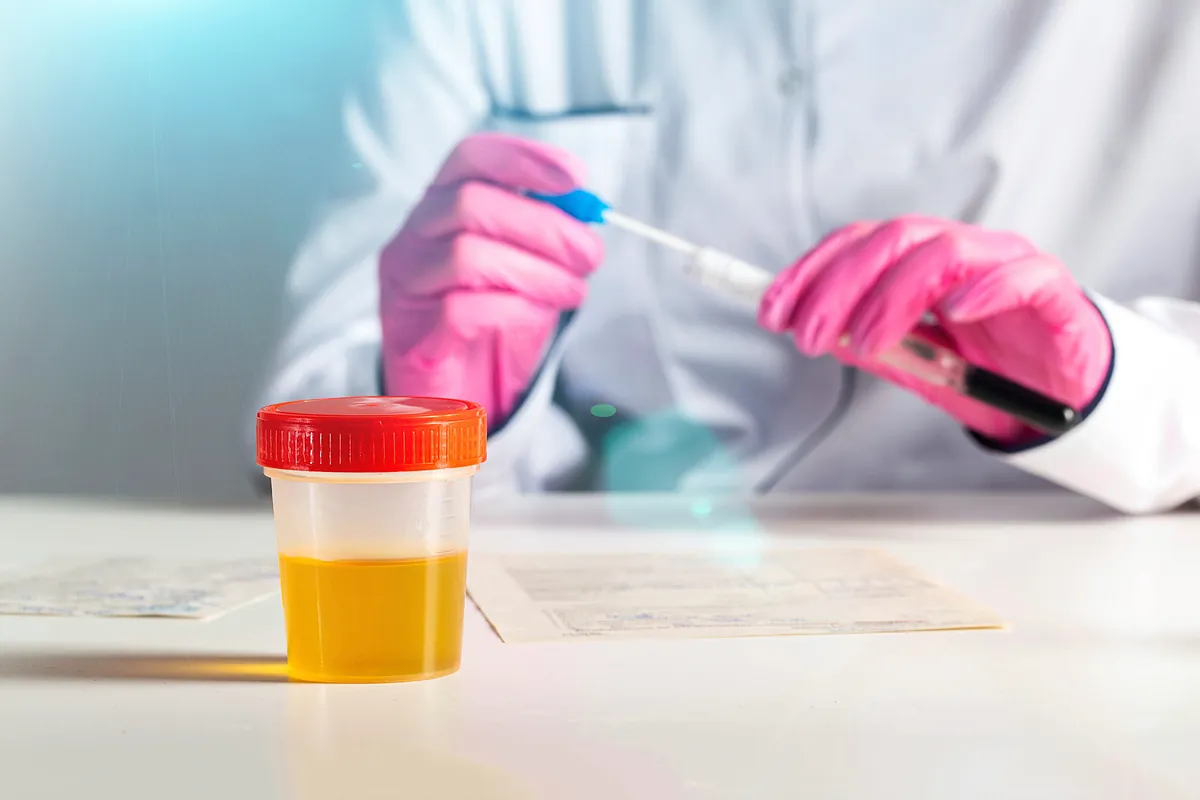 Tener tres ITU en seis meses aumenta cinco veces el riesgo de cáncer de vejiga en personas mayores de 67 años;