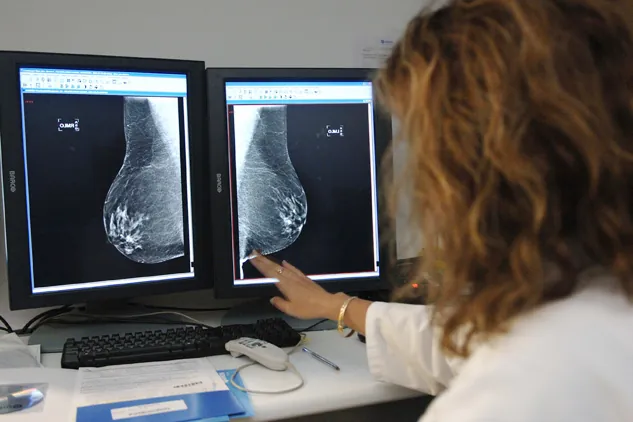 Un mapa más detallado de la mama muestra por qué la menopausia abre la puerta al cáncer