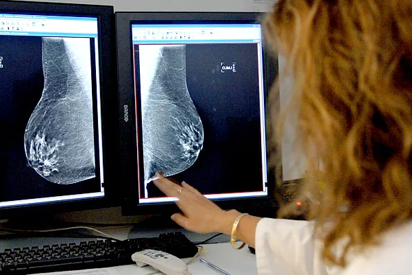 Sanidad aprueba ampliar el cribado de cáncer de mama a mujeres de 45 a 74 años