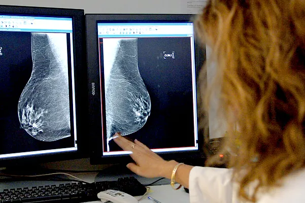 El 68% de las mujeres de 50 a 69 años declara haberse realizado una mamografía en los últimos dos años, frente al 81,5% en 2017.