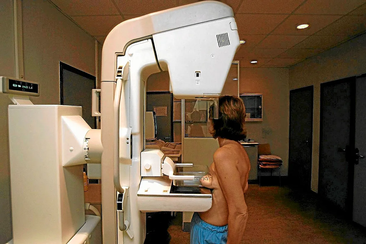 Fármacos tipo Ozemia abren una nueva vía para prevenir el cáncer de mama