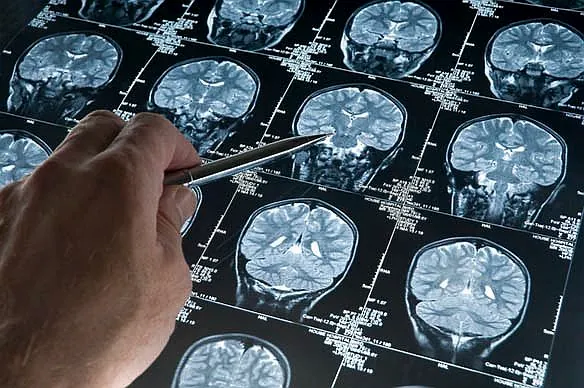 La importancia de la crítica. ventanas de plasticidad en las que "El cerebro absorbe toda la información como una esponja."