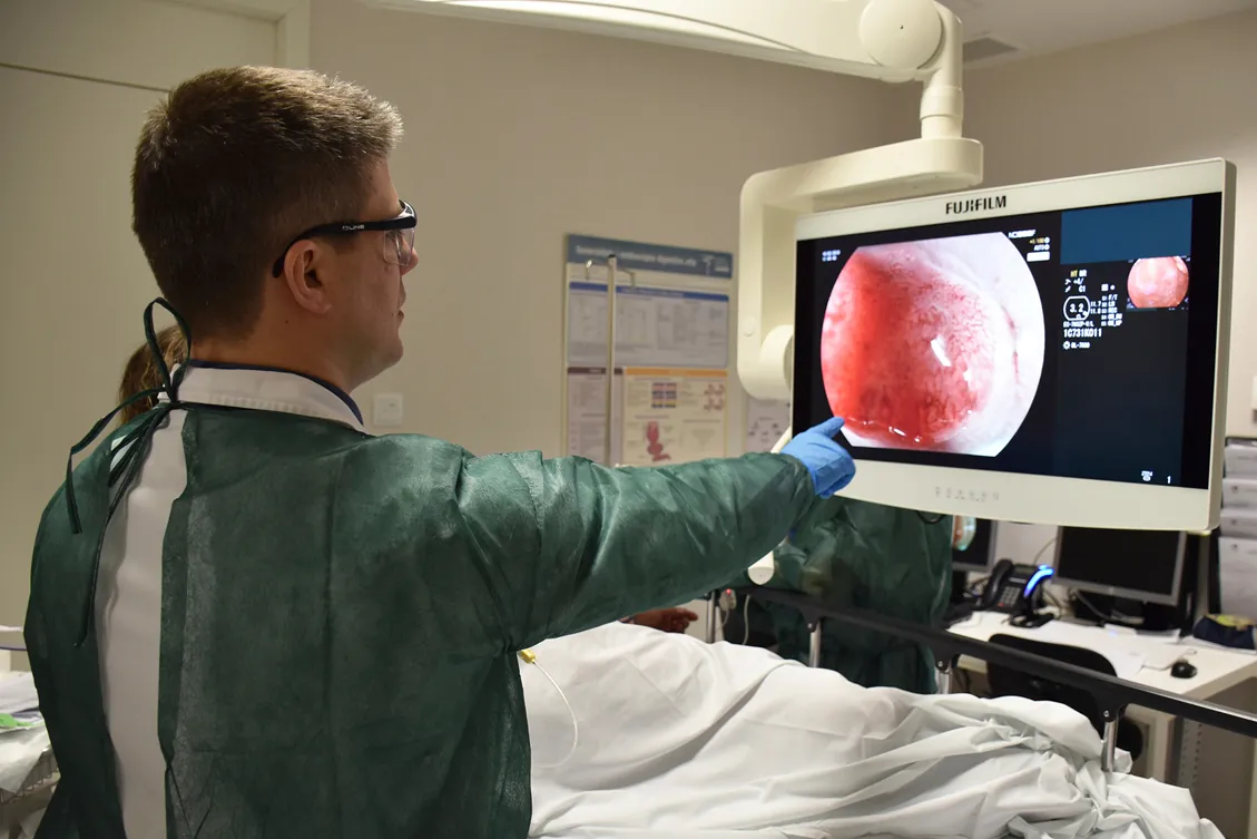 Nuevas pruebas para detectar el cáncer de colon