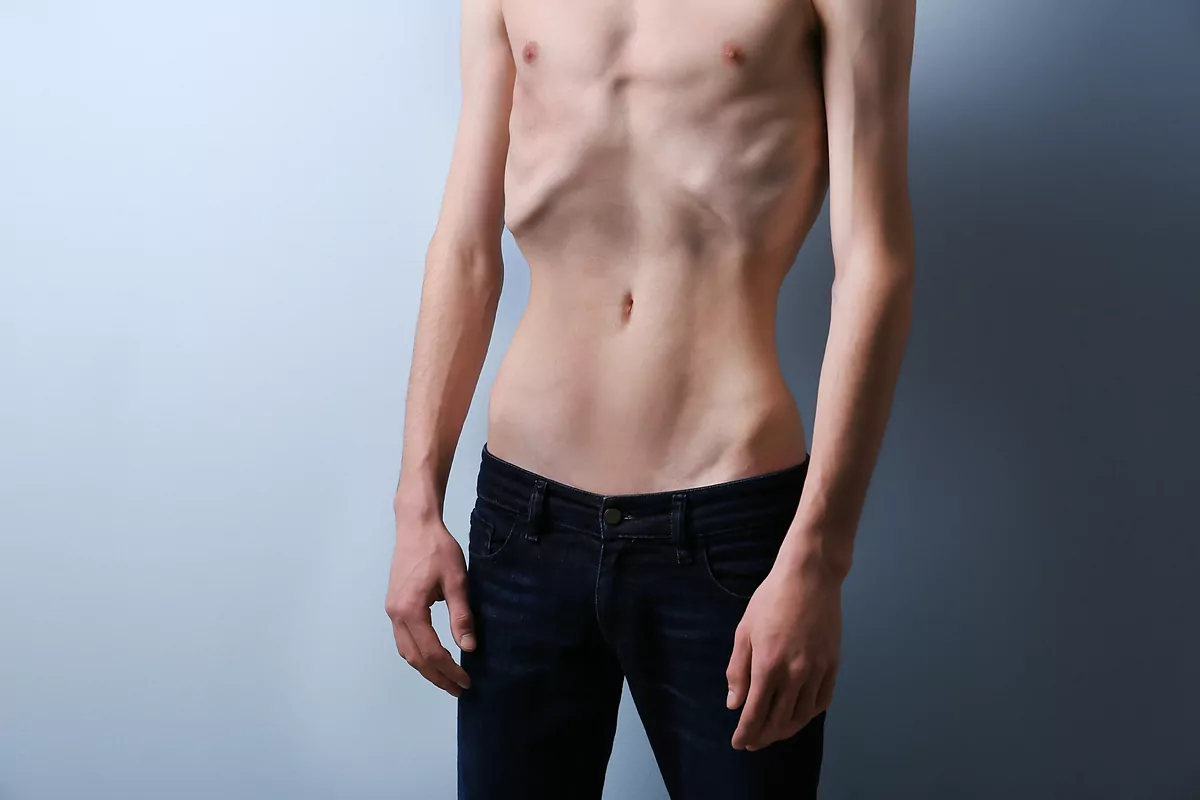 Ortorexia, permarexia o alcoholorexia. Los trastornos alimentarios inespecíficos casi se duplican con la bulimia nerviosa y la anorexia nerviosa tradicionales.