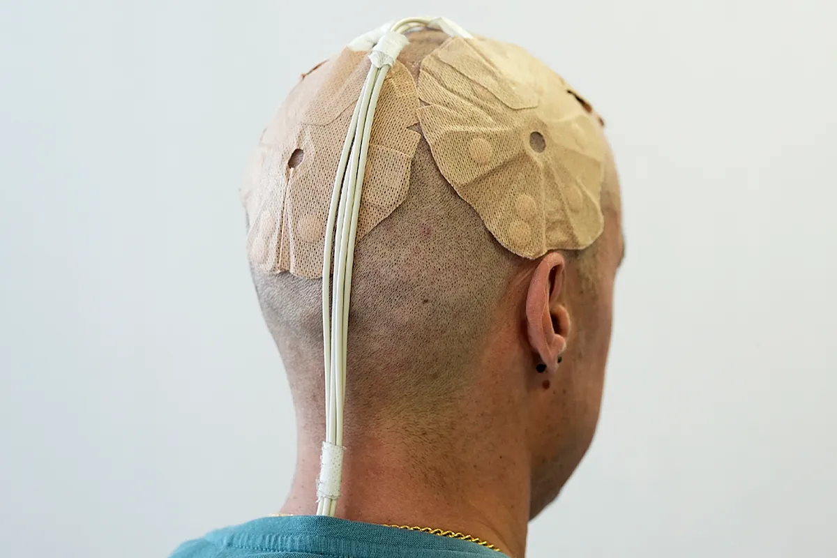 Una estrategia experimental que Pablo está probando contra el tumor cerebral más agresivo