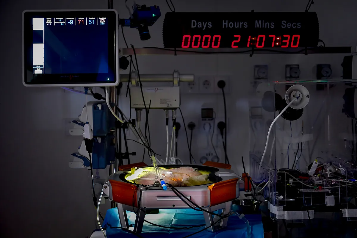 Más cerca de la placenta artificial española para bebés extremadamente prematuros. el prototipo asegura la supervivencia de un feto de oveja durante 21 días
