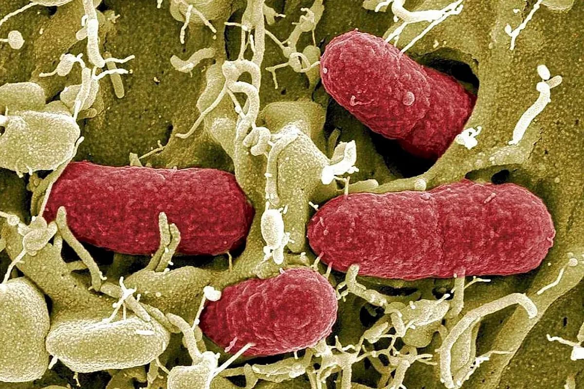 Un antibiótico «clásico» que combate las infecciones por enterobacterias multirresistentes